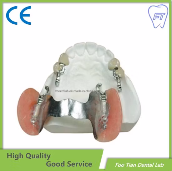 Removable Denture Cobalt Chrome Casting Framework Customized Good Product