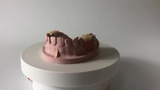 Removable Denture Cobalt Chrome Casting Framework Customized Good Product