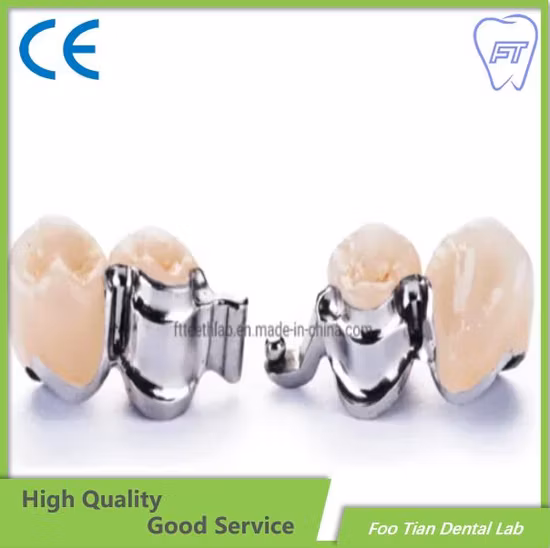 Removable Denture Cobalt Chrome Casting Framework Customized Good Product